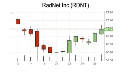 candlestick pattern